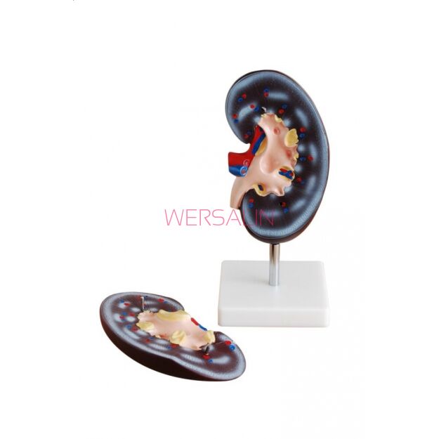 Model nerki MA-310-2